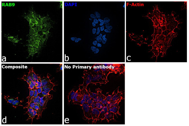 RAB9 Antibody in Immunocytochemistry (ICC/IF)