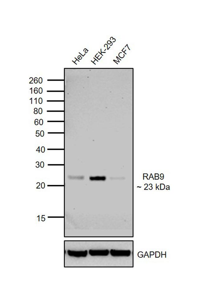 RAB9 Antibody in Western Blot (WB)