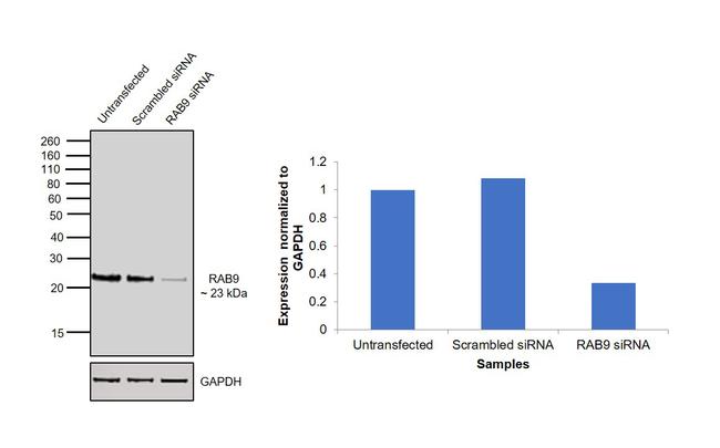 RAB9 Antibody in Western Blot (WB)