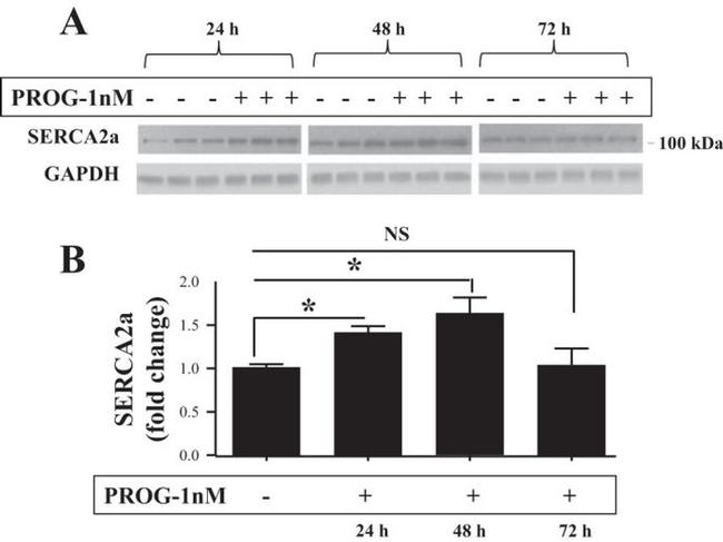 SERCA2 ATPase Antibody in Western Blot (WB)