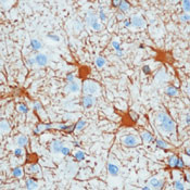 GFAP Antibody in Immunohistochemistry (Paraffin) (IHC (P))