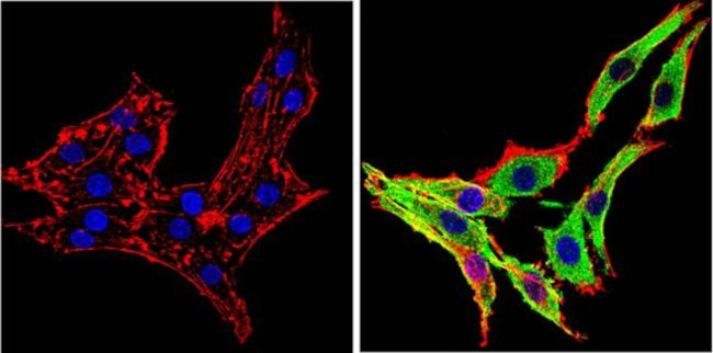 alpha Synuclein Antibody in Immunocytochemistry (ICC/IF)