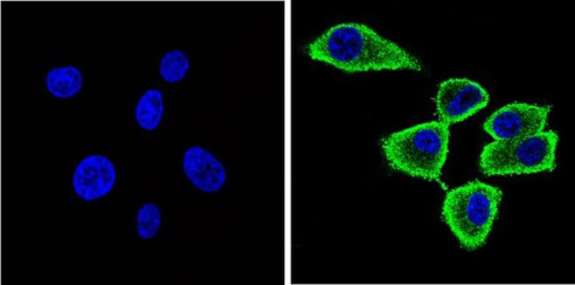 alpha Synuclein Antibody in Immunocytochemistry (ICC/IF)