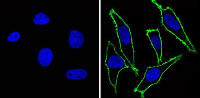 EGFR Antibody in Immunocytochemistry (ICC/IF)