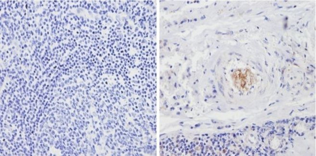 Thrombospondin 1 Antibody in Immunohistochemistry (Paraffin) (IHC (P))