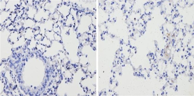 Thrombospondin 1 Antibody in Immunohistochemistry (Paraffin) (IHC (P))