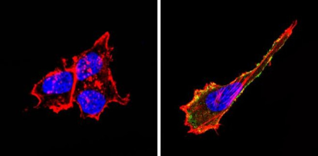 CD155 Antibody in Immunocytochemistry (ICC/IF)