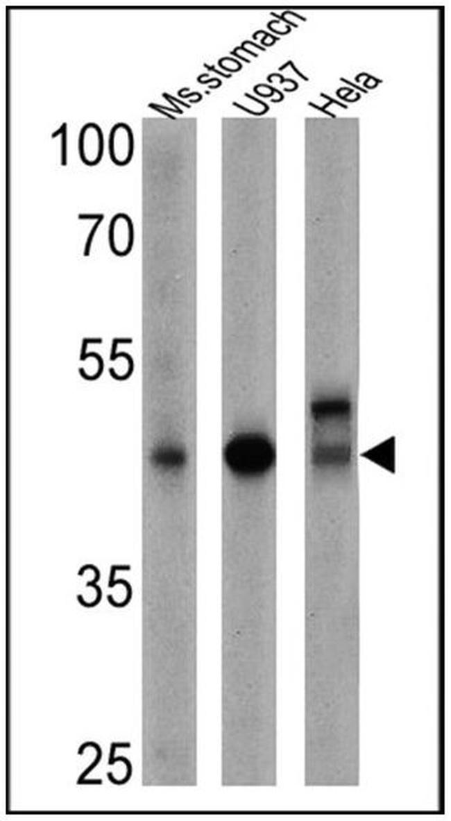 CD155 Antibody in Western Blot (WB)