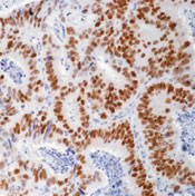 p53 Antibody in Immunohistochemistry (Paraffin) (IHC (P))