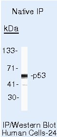 p53 Antibody in Immunoprecipitation (IP)