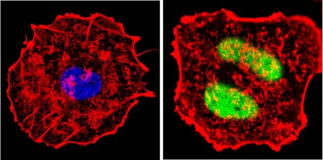 Cyclin D1 Antibody in Immunocytochemistry (ICC/IF)