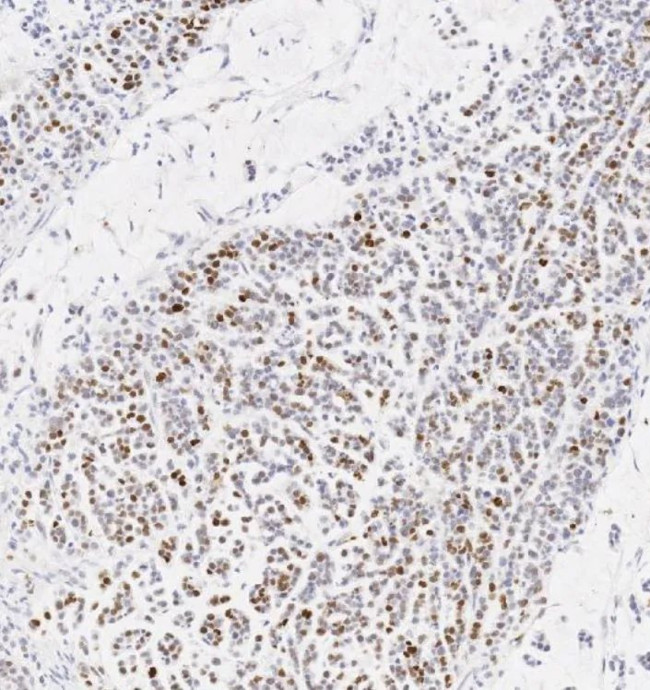 p53 Antibody in Immunohistochemistry (Paraffin) (IHC (P))