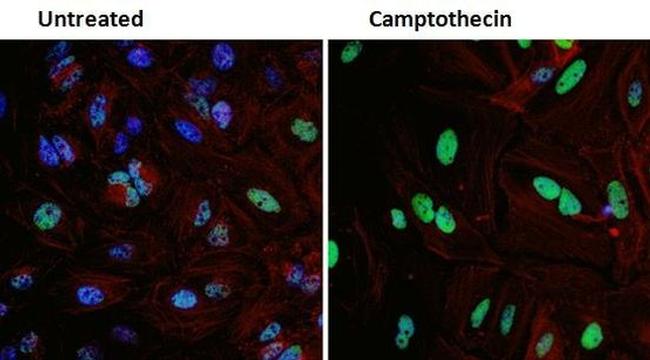 p53 Antibody