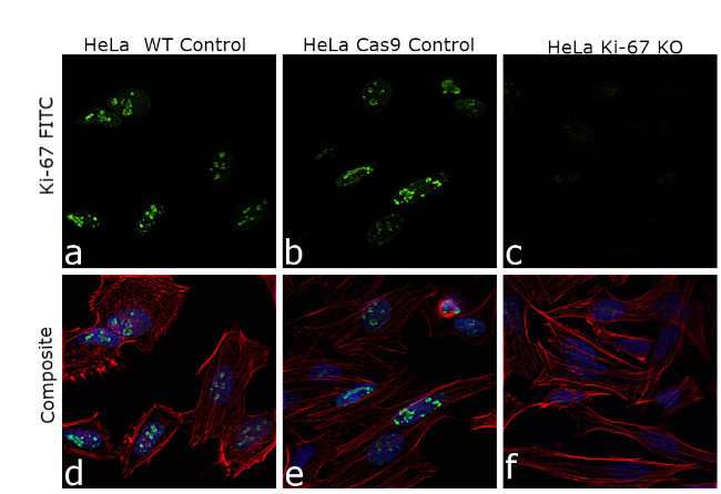 Ki-67 Antibody in Immunocytochemistry (ICC/IF)