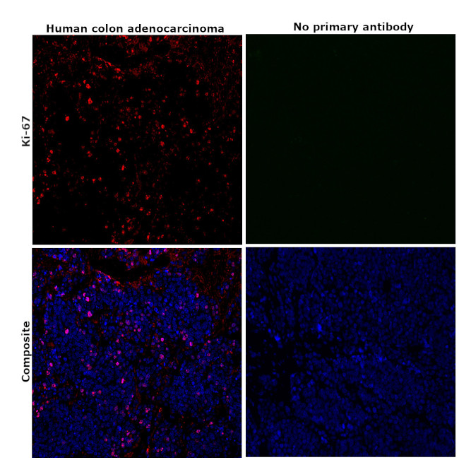 Ki-67 Antibody in Immunohistochemistry (Paraffin) (IHC (P))