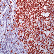 Ki-67 Antibody in Immunohistochemistry (Paraffin) (IHC (P))