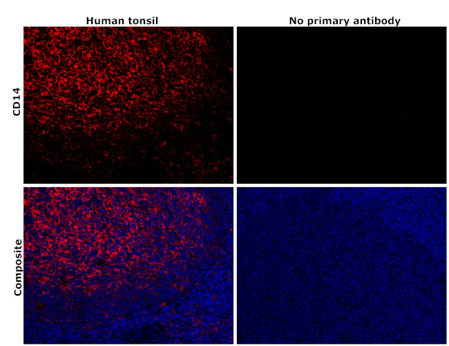 CD14 Antibody in Immunohistochemistry (Paraffin) (IHC (P))