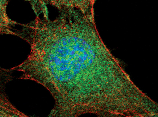 AKT Pan Antibody in Immunocytochemistry (ICC/IF)