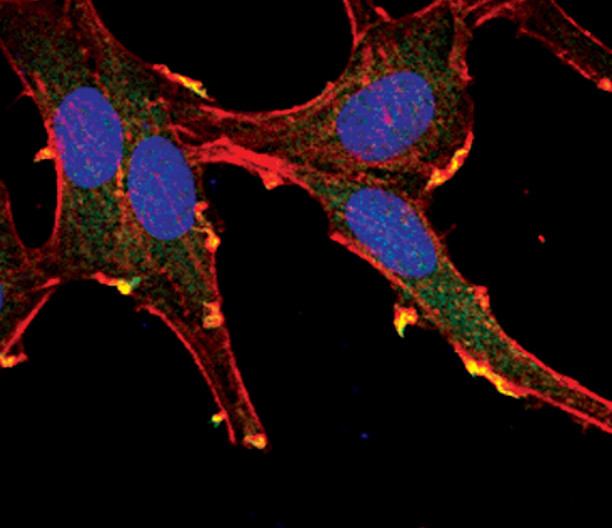 AKT Pan Antibody in Immunocytochemistry (ICC/IF)