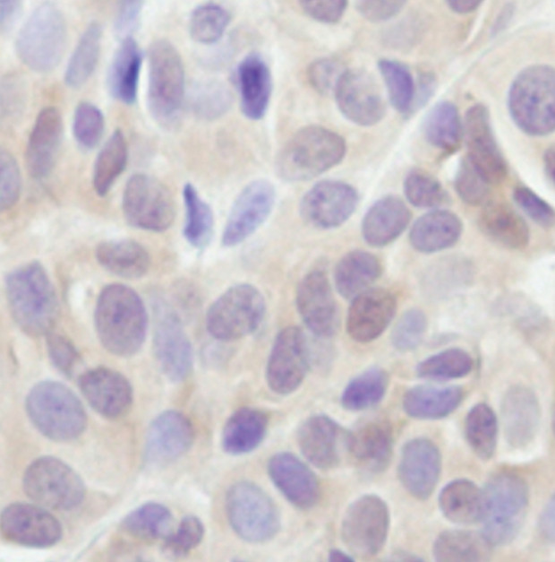 AKT Pan Antibody in Immunohistochemistry (Paraffin) (IHC (P))