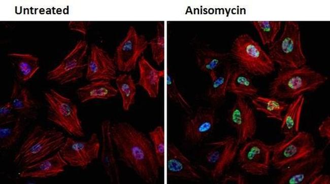 Phospho-JNK1/JNK2 (Thr183, Tyr185) Antibody