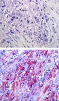 TLR4 Antibody in Immunohistochemistry (Paraffin) (IHC (P))