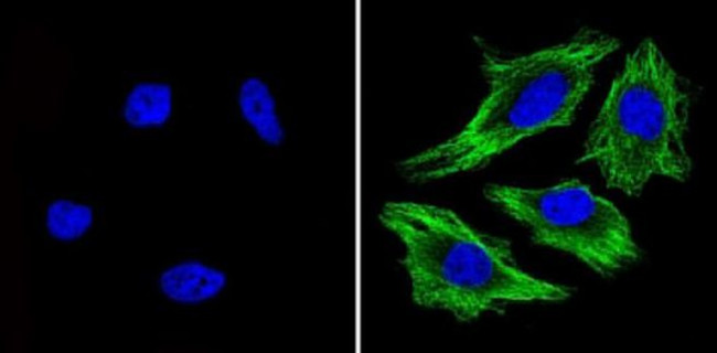 beta Tubulin Loading Control Antibody in Immunocytochemistry (ICC/IF)