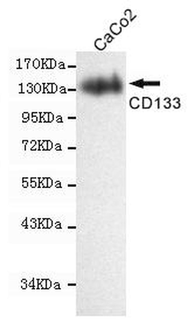 CD133 Antibody in Western Blot (WB)