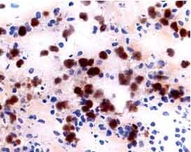 CD122 Antibody in Immunohistochemistry (Frozen) (IHC (F))