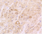 IFNAR1 Antibody in Immunohistochemistry (Paraffin) (IHC (P))