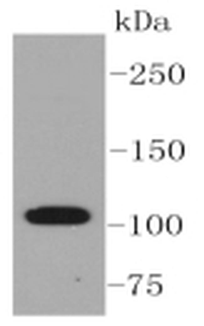 ABCG1 Antibody in Western Blot (WB)