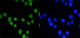 ASH2L Antibody in Immunocytochemistry (ICC/IF)