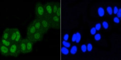 ASH2L Antibody in Immunocytochemistry (ICC/IF)