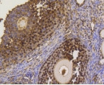 ASH2L Antibody in Immunohistochemistry (Paraffin) (IHC (P))