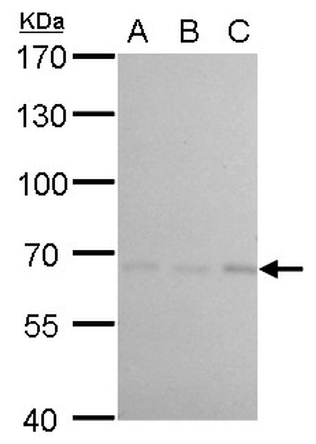 cIAP1 Antibody in Western Blot (WB)