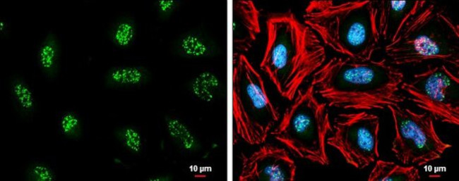 cIAP1 Antibody in Immunocytochemistry (ICC/IF)