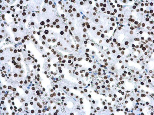 H4K16ac Antibody in Immunohistochemistry (Paraffin) (IHC (P))