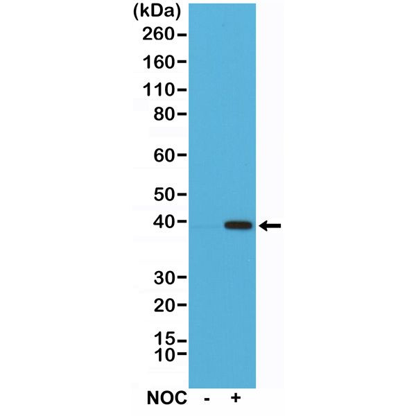 Aurora B Antibody in Western Blot (WB)