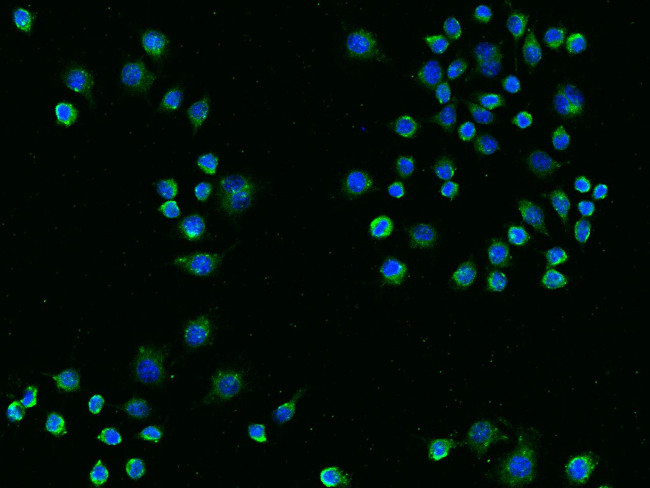 TREM2 Antibody in Immunocytochemistry (ICC/IF)