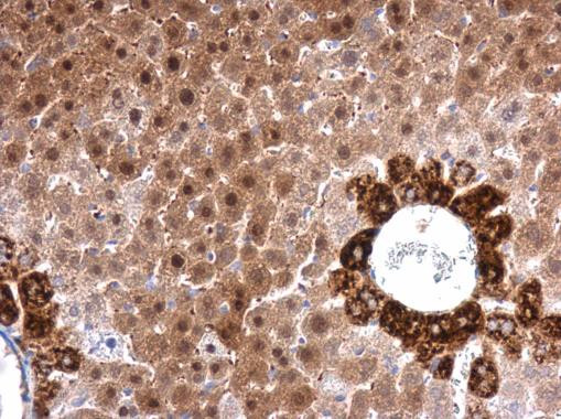 ACSL4 Antibody in Immunohistochemistry (Paraffin) (IHC (P))