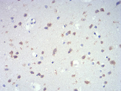 IL-28A Antibody in Immunohistochemistry (Paraffin) (IHC (P))