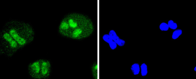 SIRT1 Antibody in Immunocytochemistry (ICC/IF)