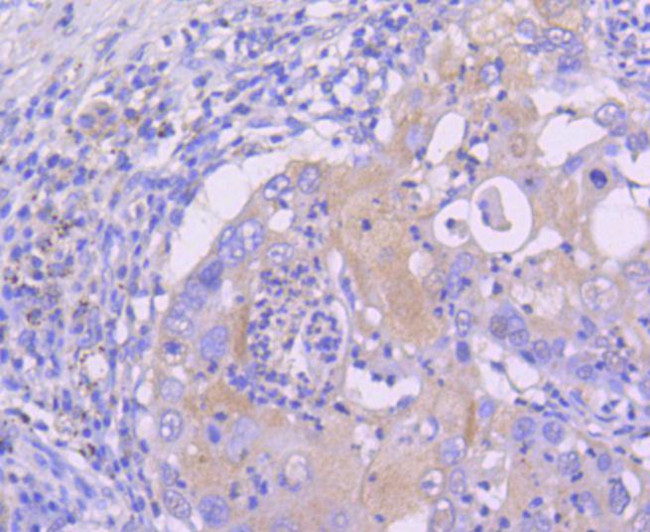 SIRT1 Antibody in Immunohistochemistry (Paraffin) (IHC (P))