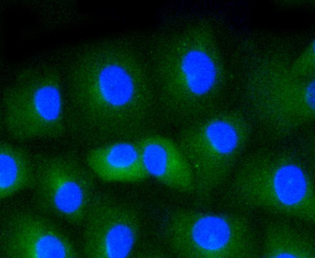 CD34 Antibody in Immunocytochemistry (ICC/IF)