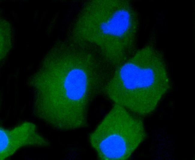 CD34 Antibody in Immunocytochemistry (ICC/IF)