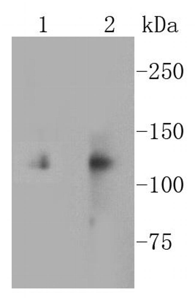 CD51 Antibody in Western Blot (WB)