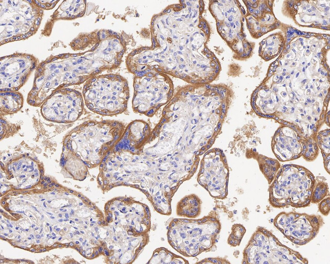 CD51 Antibody in Immunohistochemistry (Paraffin) (IHC (P))