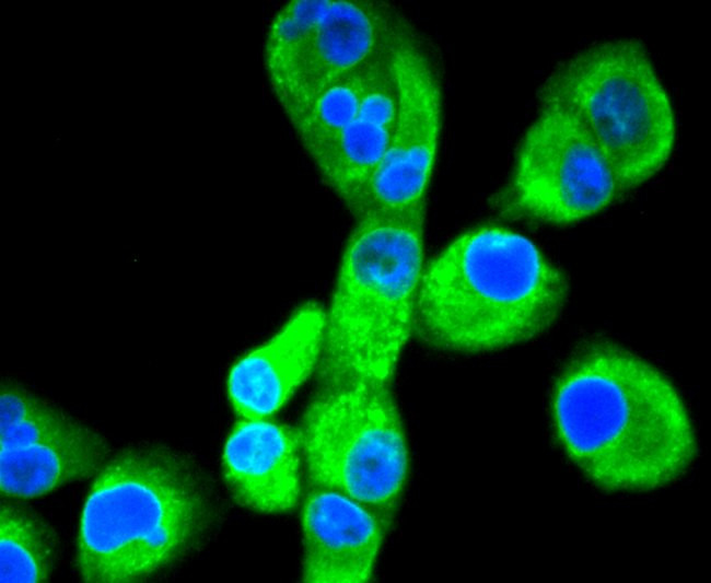 Calnexin Antibody in Immunocytochemistry (ICC/IF)