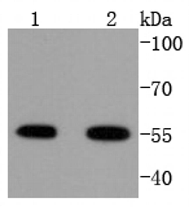 ATF4 Antibody in Western Blot (WB)