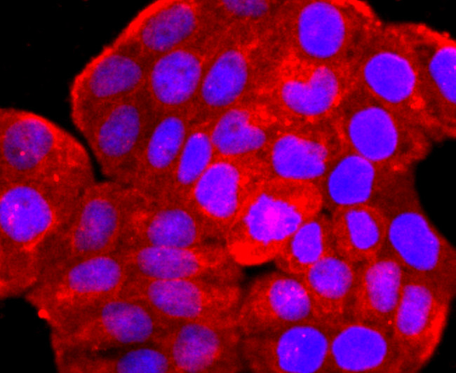 ARF6 Antibody in Immunocytochemistry (ICC/IF)